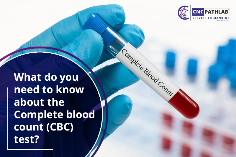 What do you need to know about the Complete blood count (CBC) test?