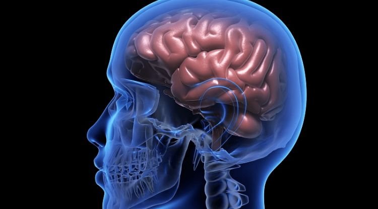 Hemorrhagic Stroke Symptoms