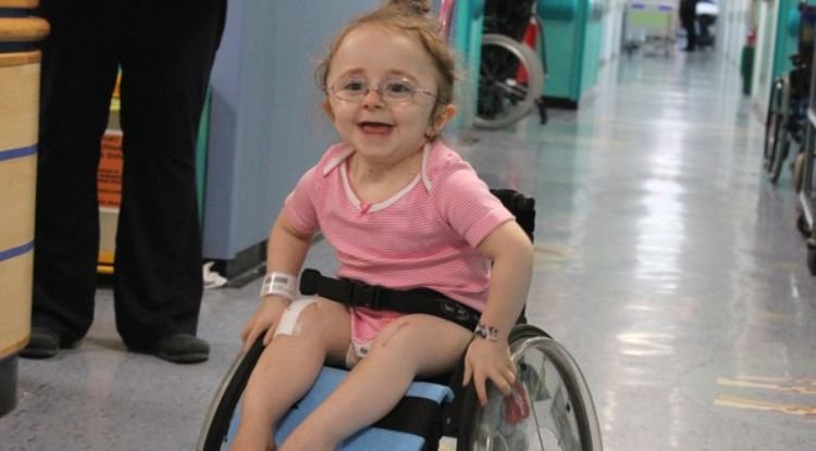 Osteogenesis Imperfecta Symptoms