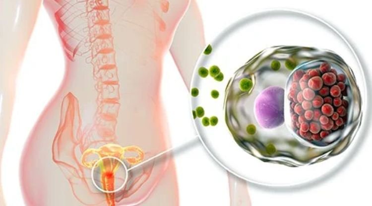 Chlamydia Infection Symptoms