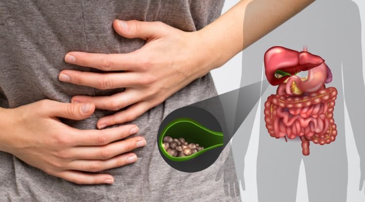 Gallstones Symptoms