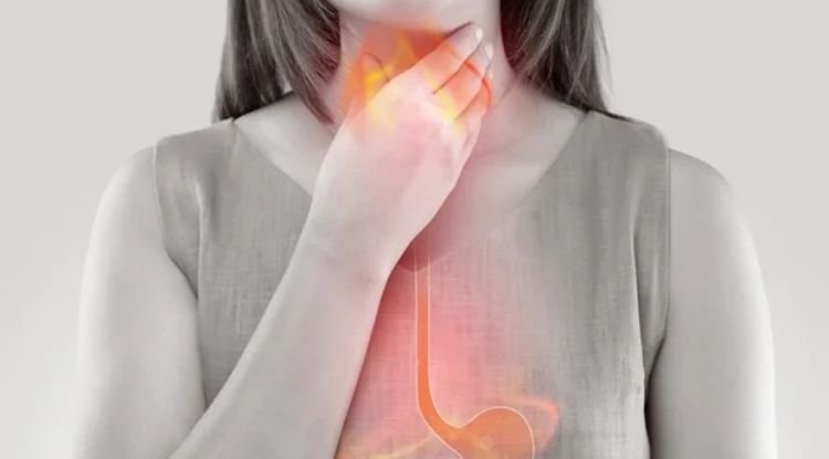 Gastroesophageal Reflux Disease Symptoms