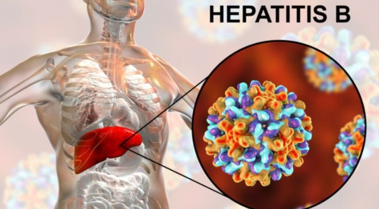 Hepatitis B Symptoms