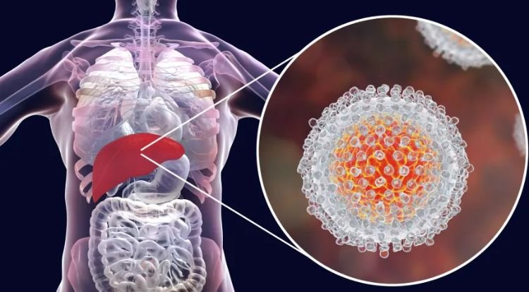 Hepatitis C Symptoms