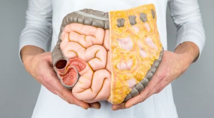 Intestinal Cancer Symptoms