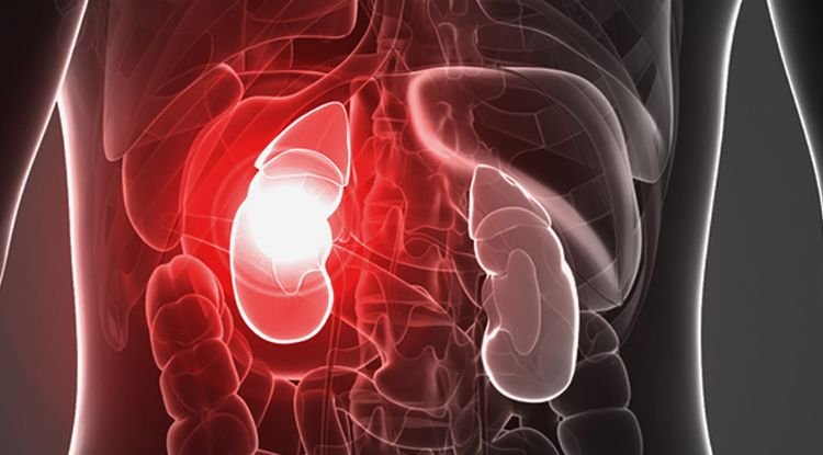 Kidney Failure Symptoms