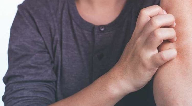 Leishmaniasis Symptoms