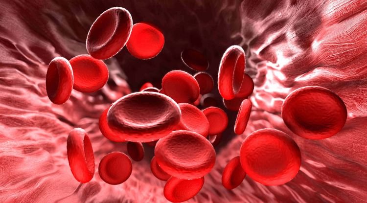 Myelodysplastic Syndrome Symptoms