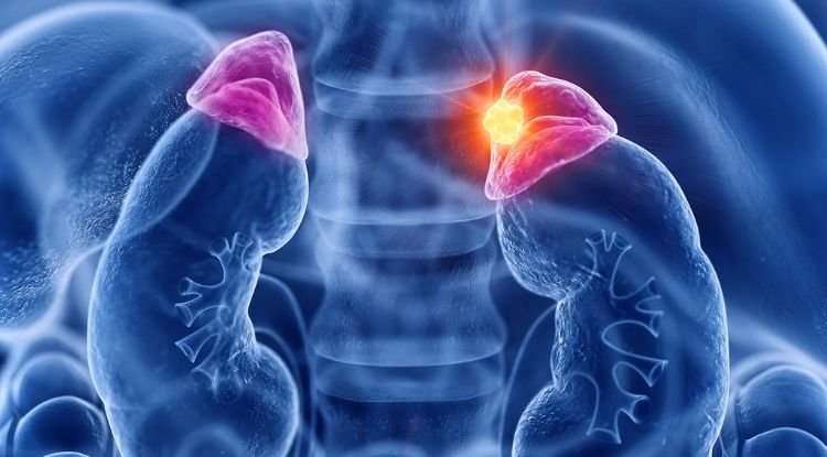 Adrenal Gland Cancer Symptoms